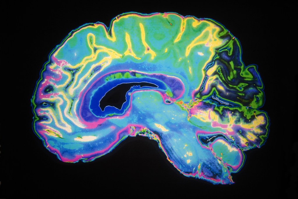 Spring 2026 Alzheimer's Updates: New Blood Tests & Treatments
